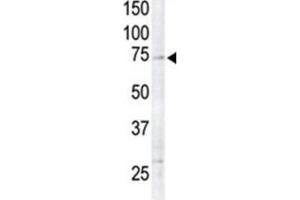 Western Blotting (WB) image for anti-Ribosomal Protein S6 Kinase, 90kDa, Polypeptide 6 (RPS6KA6) antibody (ABIN3003591) (RPS6KA6 antibody)