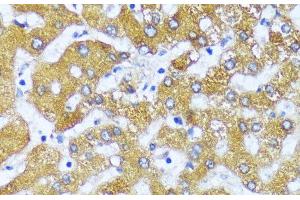 Immunohistochemistry of paraffin-embedded Human liver using ACOX2 Polyclonal Antibody at dilution of 1:100 (40x lens). (Acox2 antibody)