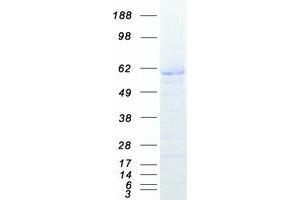 Validation with Western Blot (XIAP Protein (Myc-DYKDDDDK Tag))
