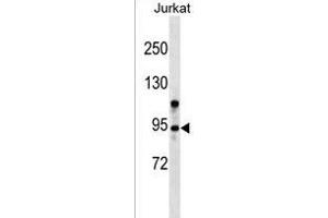 ZMYM6 Antibody (N-term) (ABIN1539123 and ABIN2849256) western blot analysis in Jurkat cell line lysates (35 μg/lane). (ZMYM6 antibody  (N-Term))