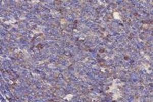 Immunohistochemistry analysis of paraffin-embedded human tonsil using,RPL10 (ABIN7075428) at dilution of 1: 4000 (RPL10 antibody)