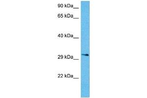 Host:  Mouse  Target Name:  KCNIP3  Sample Tissue:  Mouse Brain  Antibody Dilution:  1ug/ml (DREAM antibody  (N-Term))