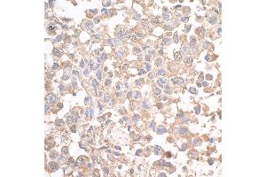 Immunohistochemistry (IHC) image for anti-Sperm Associated Antigen 9 (SPAG9) (AA 1-50) antibody (ABIN7454611)