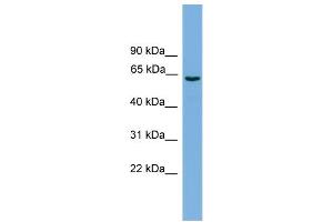 Western Blotting (WB) image for anti-Solute Carrier Organic Anion Transporter Family, Member 1A2 (SLCO1A2) (Middle Region) antibody (ABIN2781619)
