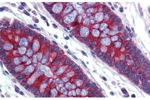 Human Colon; Immunohistochemistry with Human Colon lysate tissue at an antibody concentration of 5. (ABCA5 antibody  (C-Term))