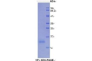 SDS-PAGE (SDS) image for Angiopoietin 2 (ANGPT2) (AA 19-147) protein (His tag) (ABIN1078788)