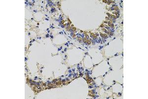 Immunohistochemistry of paraffin-embedded mouse lung using CD59 antibody. (CD59 antibody)