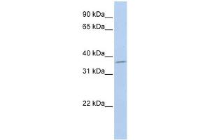 WB Suggested Anti-SLFNL1 Antibody Titration: 0. (Schlafen-Like 1 antibody  (Middle Region))