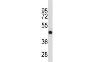 OPG antibody western blot analysis in NCI-H460 lysate.
