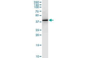 PTX3 monoclonal antibody (M01), clone 5B7. (PTX3 antibody  (AA 282-380))