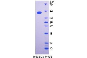 SDS-PAGE (SDS) image for serine Palmitoyltransferase, Long Chain Base Subunit 1 (SPTLC1) (AA 143-473) protein (His tag) (ABIN4990663)
