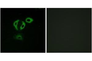 Immunofluorescence analysis of A549 cells, using TACC3 Antibody. (TACC3 antibody  (AA 789-838))