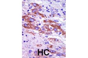 Immunohistochemistry (IHC) image for anti-Casein Kinase 1, delta (CSNK1D) antibody (ABIN3003190)