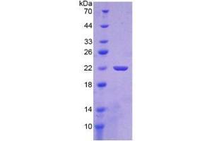 SDS-PAGE of Protein Standard from the Kit  (Highly purified E. (Sonic Hedgehog ELISA Kit)