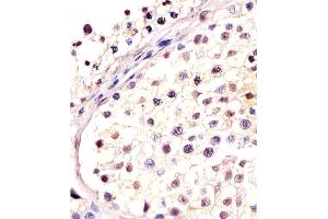 Antibody staining DPPA4 in human testis tissue sections by Immunohistochemistry (IHC-P - paraformaldehyde-fixed, paraffin-embedded sections). (DPPA4 antibody  (N-Term))