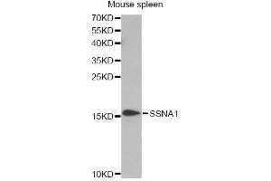 Western blot analysis of extracts of mouse spleen, using SSNA1 antibody. (SSNA1 antibody)
