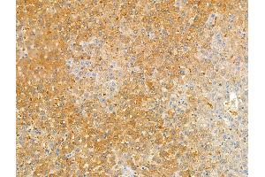ABIN7094504 and ABIN7098553 at 1/100 staining Rat liver tissue by IHC-P. (Kallikrein 9 antibody  (C-Term))