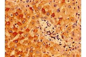 Immunohistochemistry of paraffin-embedded human liver tissue using ABIN7156987 at dilution of 1:100