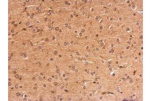 IHC-P Image MC1 Receptor antibody [C2C3], C-term detects MC1R protein at membrane on mouse fore brain by immunohistochemical analysis. (MC1 Receptor antibody  (C-Term))