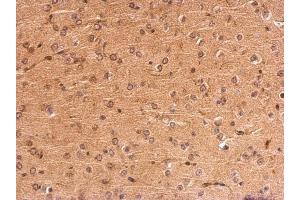 IHC-P Image MC1 Receptor antibody [C2C3], C-term detects MC1R protein at membrane on mouse fore brain by immunohistochemical analysis.