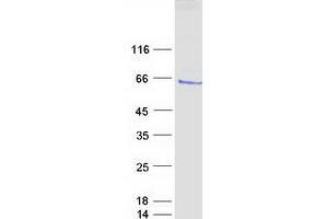 Validation with Western Blot (ETV1 Protein (Myc-DYKDDDDK Tag))