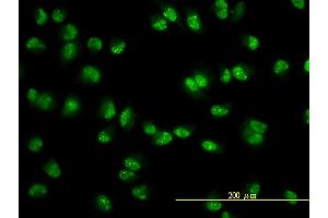 Immunofluorescence of monoclonal antibody to USP15 on HeLa cell.