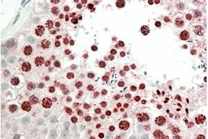 Immunohistochemistry (IHC) image for anti-Homeobox A10 (HOXA10) (Internal Region) antibody (ABIN1590026)