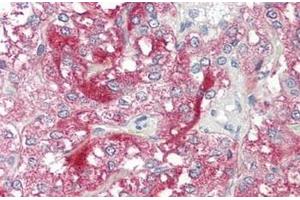 Human Adrenal: Formalin-Fixed, Paraffin-Embedded (FFPE) (Neurexophilin 1 antibody  (C-Term))