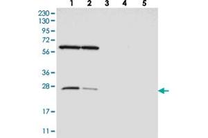Western blot analysis of Lane 1: RT-4, Lane 2: U-251 MG, Lane 3: Human Plasma, Lane 4: Liver, Lane 5: Tonsil with MRPS15 polyclonal antibody .