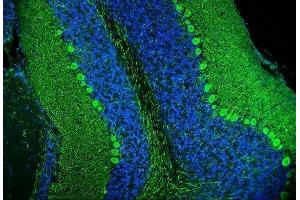 IF analysis of Calbindin using anti-Calbindin antibody (ABIN6719541). (CALB1 antibody  (AA 2-261))
