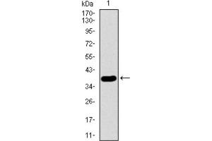 Western blot analysis using SFTPC antibody against HEK293 (1) and SFTPC (AA: 60-180) -hIgGFc transfected HEK293 (2) cell lysate. (Surfactant Protein C antibody  (AA 60-180))