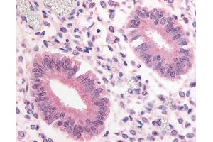 Anti-PDE3A antibody IHC of human uterus. (PDE3A antibody  (Internal Region))