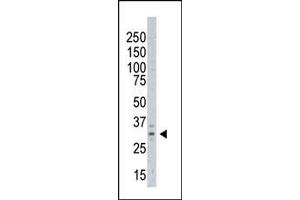 The anti-AURKC Pab (ABIN6242197 and ABIN6578977) is used in Western blot to detect AURKC in  cell lysate (Aurora Kinase C antibody  (C-Term))