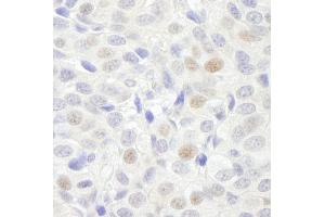 Immunohistochemistry (IHC) image for anti-General Transcription Factor 3C Polypeptide 3 (GTF3C3) (AA 475-525) antibody (ABIN7448586) (General Transcription Factor 3C Polypeptide 3 (GTF3C3) (AA 475-525) antibody)