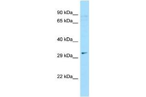 WB Suggested Anti-C9orf24 Antibody Titration: 1. (C9orf24 antibody  (N-Term))