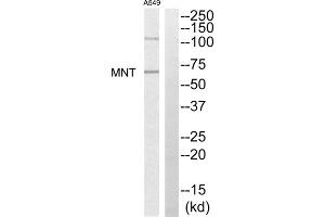 Western blot analysis of extracts from A549 cells, using MNT antibody. (MNT antibody  (Internal Region))