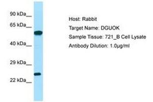 Image no. 1 for anti-Deoxyguanosine Kinase (DGUOK) (C-Term) antibody (ABIN6749986) (Deoxyguanosine Kinase antibody  (C-Term))