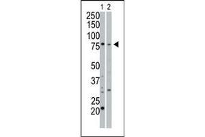 Image no. 1 for anti-Protein Kinase, CGMP-Dependent, Type I (PRKG1) (C-Term) antibody (ABIN360422)
