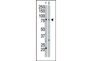 Image no. 1 for anti-Protein Kinase, CGMP-Dependent, Type I (PRKG1) (C-Term) antibody (ABIN360422) (PRKG1 antibody  (C-Term))