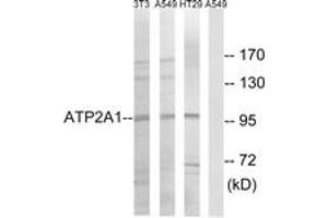 Western blot analysis of extracts from HT-29/A549/NIH-3T3 cells, using ATP2A1 Antibody. (ATP2A1/SERCA1 antibody  (AA 548-597))