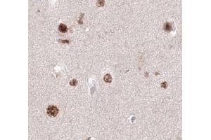 ABIN6278585 staining KIF20A in human brain tissue by Immunohistochemistry (Formalin/PFA-fixed paraffin-embedded sections). (KIF20A antibody  (C-Term))