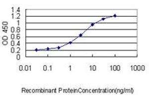 Detection limit for recombinant GST tagged SQSTM1 is approximately 0. (SQSTM1 antibody  (AA 1-440))