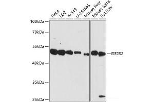 Western blot analysis of extracts of various cell lines using EIF2S2 Polyclonal Antibody at dilution of 1:3000. (EIF2S2 antibody)