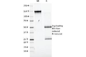 SDS-PAGE Analysis Purified CD98 Mouse Monoclonal Antibody (UM7F8). (SLC3A2 antibody)