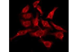 ABIN6276116 staining A549 by IF/ICC. (OR10V1 antibody  (Internal Region))