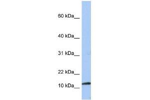 PEA15 antibody used at 1 ug/ml to detect target protein. (PEA15 antibody  (Middle Region))