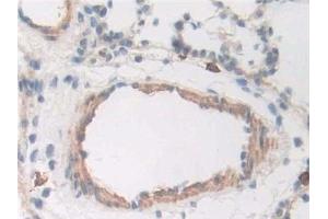 Detection of CD163 in Rat Trachea Tissue using Polyclonal Antibody to Cluster Of Differentiation (CD163) (CD163 antibody  (AA 693-939))