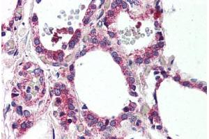 Human Thyroid (formalin-fixed, paraffin-embedded) stained with MRGPRF antibody ABIN399998 at 10 ug/ml followed by biotinylated goat anti-rabbit IgG secondary antibody ABIN481713, alkaline phosphatase-streptavidin and chromogen. (Mrgprf antibody  (N-Term))