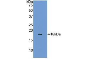 Detection of Recombinant SST, Mouse using Polyclonal Antibody to Somatostatin (SST) (Somatostatin antibody  (AA 27-116))