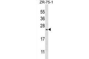 Western Blotting (WB) image for anti-BARX Homeobox 1 (BARX1) antibody (ABIN3003109) (BARX1 antibody)